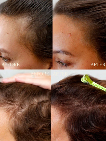 Anti Hair Loss Duo, set produktů