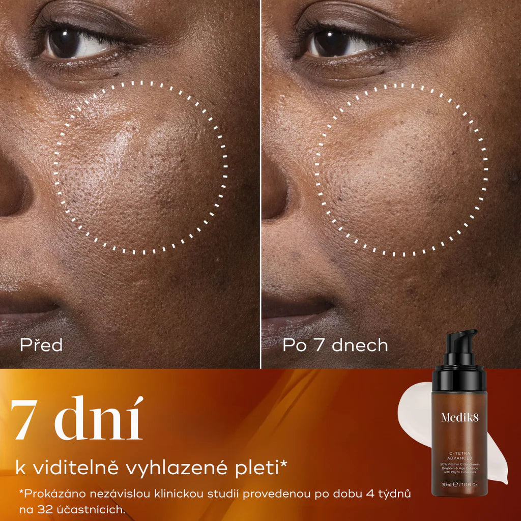 C-TETRA® ADVANCED, 30 ml