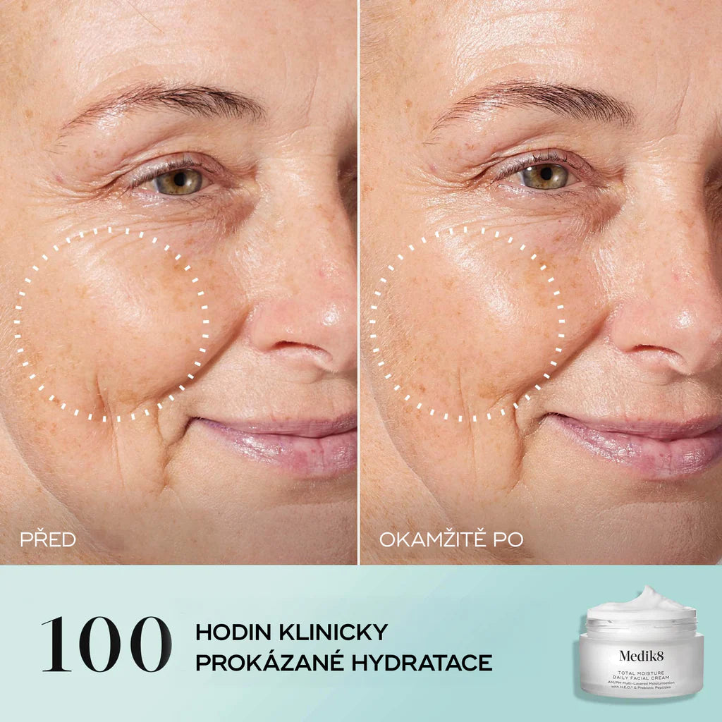 TOTAL MOISTURE DAILY FACIAL CREAM™, 50 ml