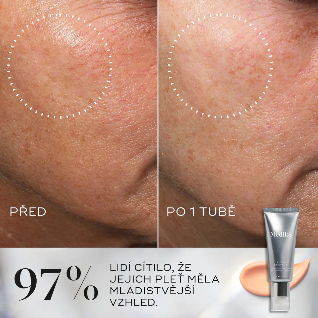 CRYSTAL RETINAL®, 30 ml