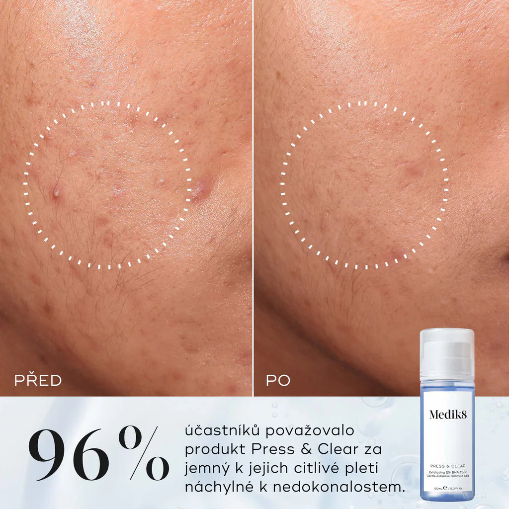 PRESS & CLEAR™, 150 ml