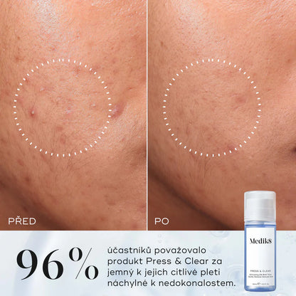 PRESS & CLEAR™, 150 ml